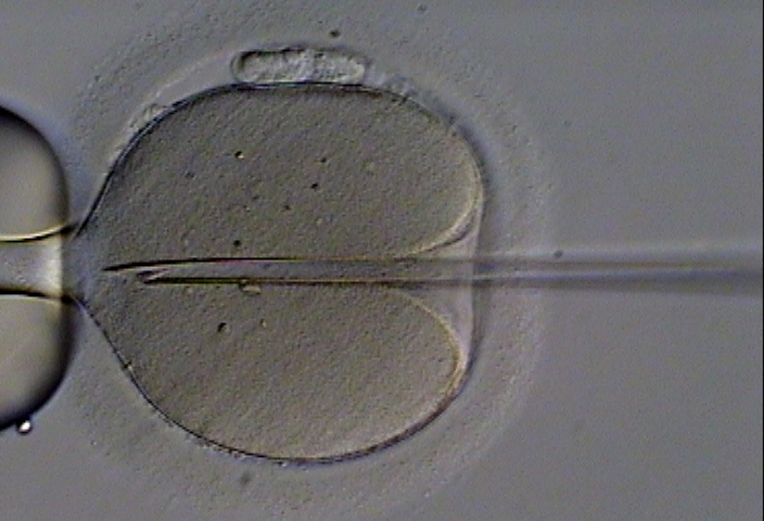 Are Sperm Banks in the Business of Eugenics?