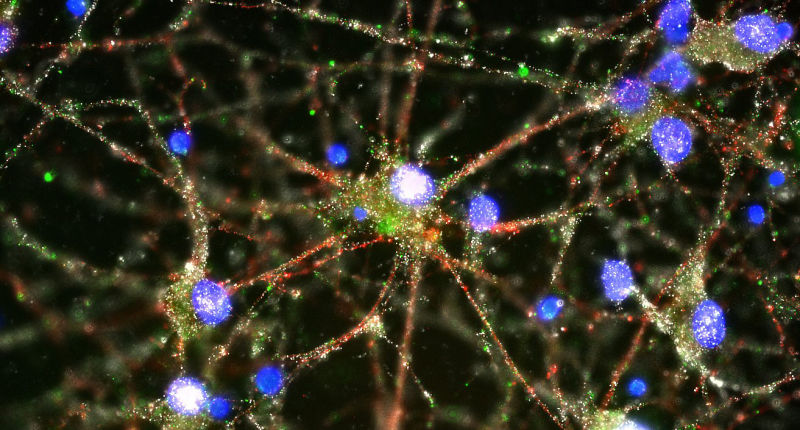 Scientists Have Finally Found a Biological Process Behind Schizophrenia