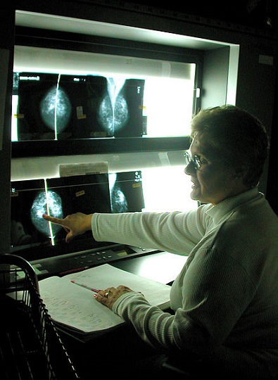 Experts Argue That Cancer Screening Doesn't Save Lives
