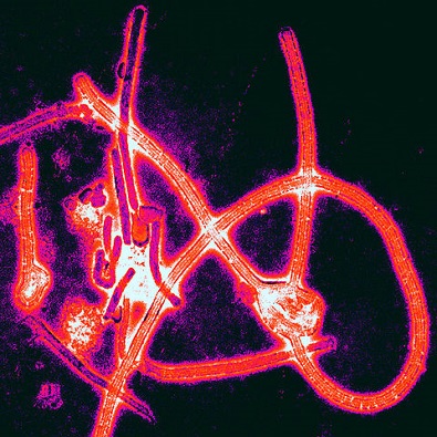 One Day We Could Treat Ebola By Turning Its Own Mutation Against It