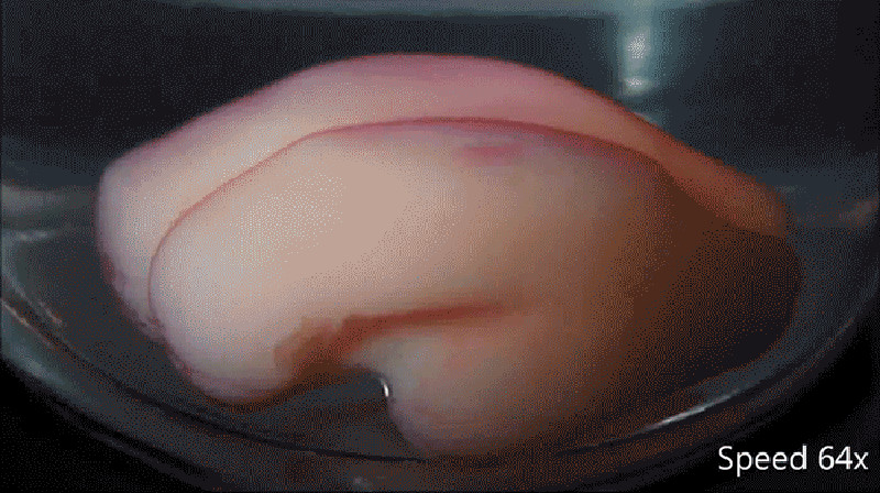 3D-Printed Gel Folds Almost Exactly Like a Real Baby Human Brain