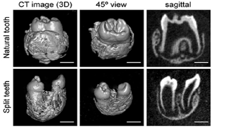 We're One Step Closer to Being Able To Regrow a Lost Tooth