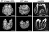 We’re One Step Closer to Being Able To Regrow a Lost Tooth