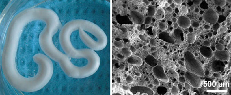Scientists Create Injectable Foam To Repair Degenerating Bones