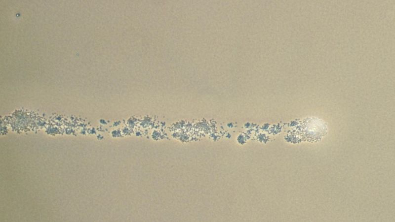 Scientists Now Know How Drug-Resistant Superbugs Move