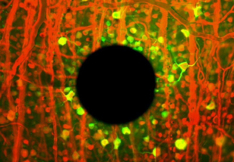 New Research Could Improve Artificial Retinas To Help a Blind Eye See