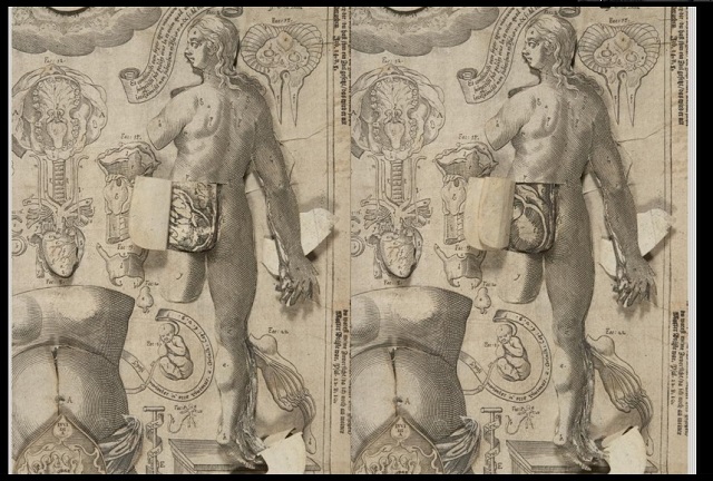 Columbia Just Digitized a Bestselling Anatomy Flipbook From the 1600s