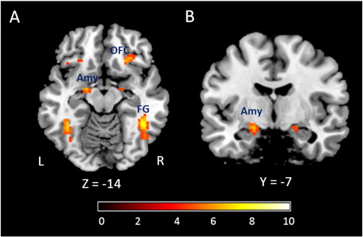 Is "Emotion Training" the Next Brain Training? Let's Hope Not