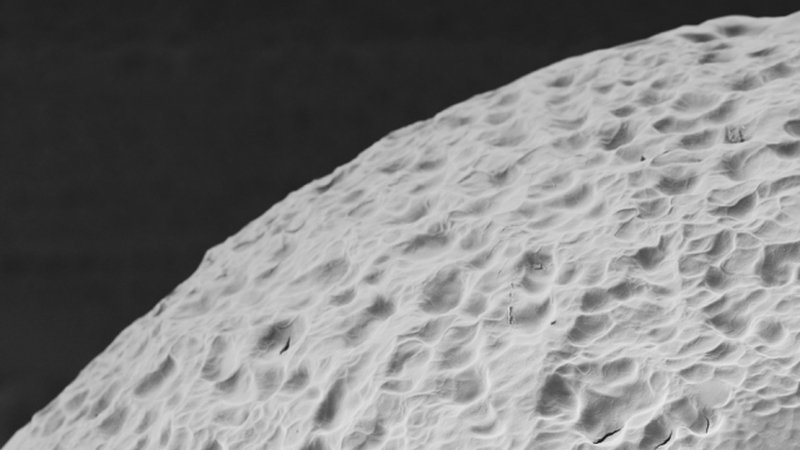 Stem Cell Breakthrough Could Put an End to Daily Insulin Injections for Diabetics