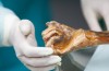 Ötzi, l’uomo venuto dal Ghiaccio dell’Intestino i Batteri Possono aiutarci Traccia Prime Migrazioni Umane
