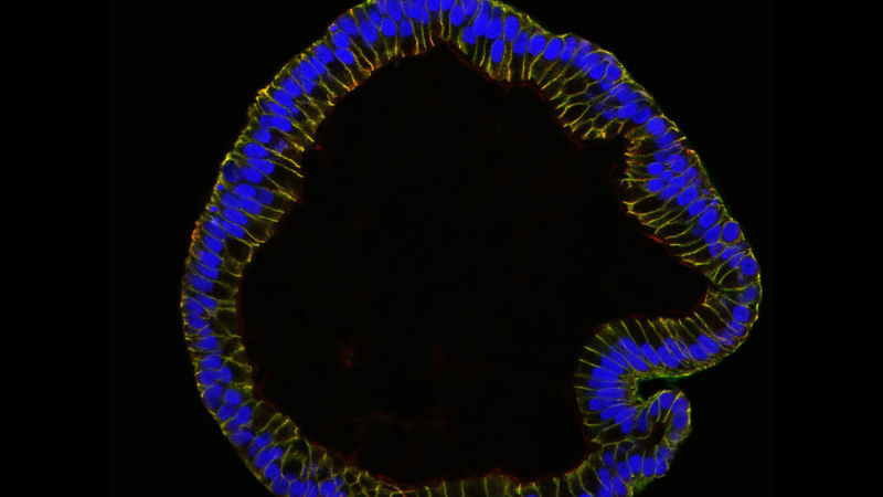 Researchers Can Now Grow Fallopian Tubes in the Lab