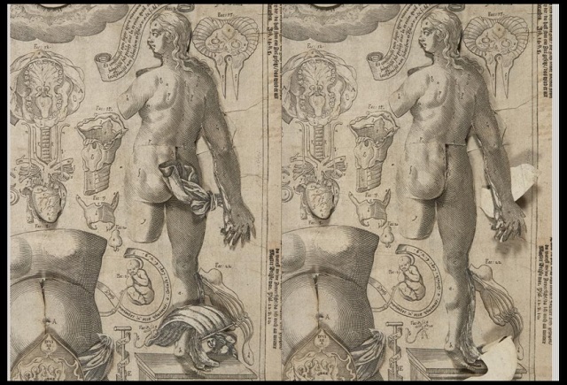 Columbia Just Digitized a Bestselling Anatomy Flipbook From the 1600s