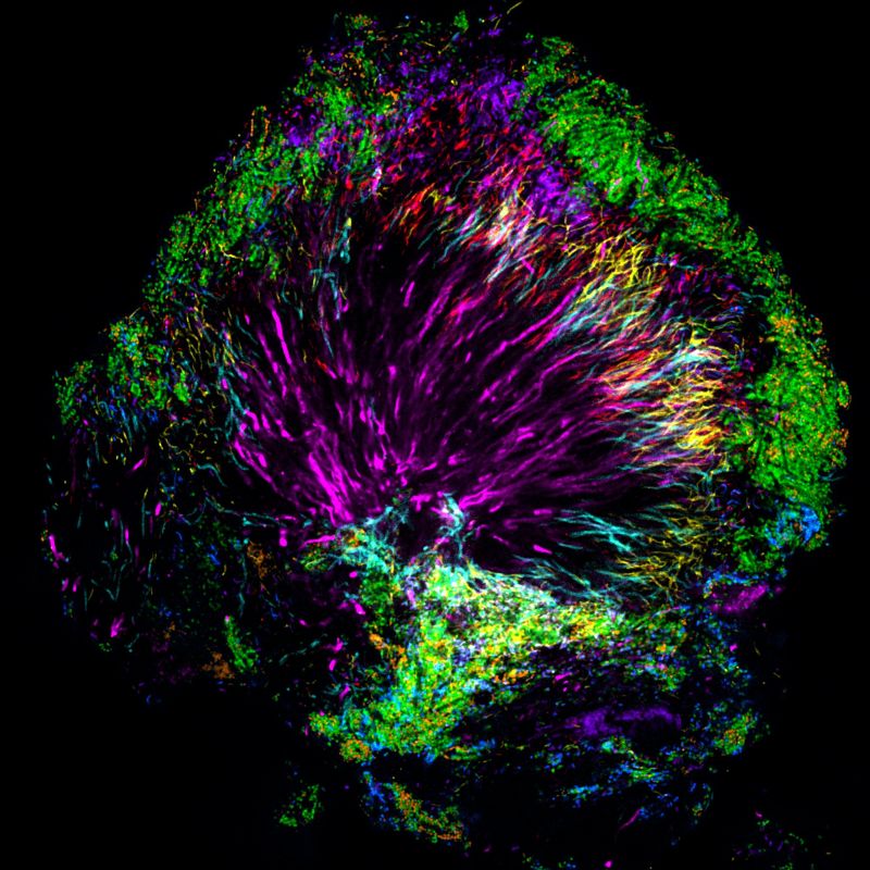 There Are Some Seriously Pyschedelic Bacteria Living on Your Teeth