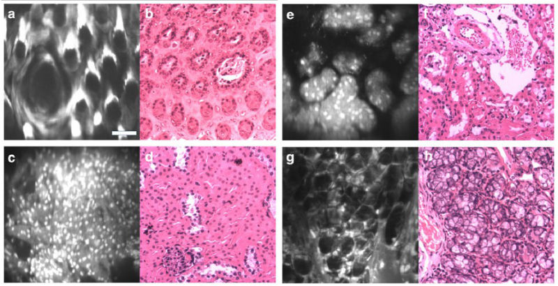 This Pen-Sized Microscope Could Spot Cancer in Your Doctor's Office