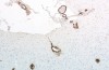 Kontroversen “Übertragbare Alzheimer’ Theorie beginnt, sieht Plausibel