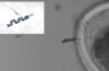 Cyborg Sperm Could Revolutionize Fertility Treatments