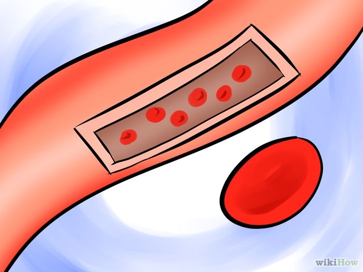 Image titled Accept Intelligent Design of the Cornea Step 6