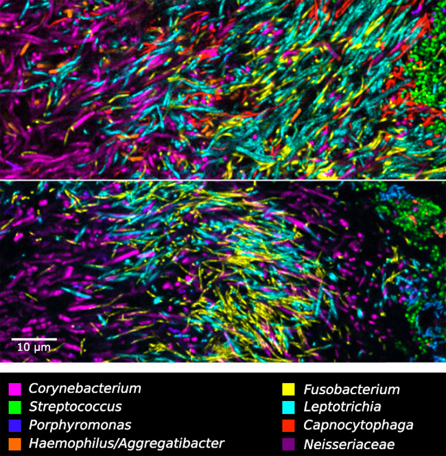 There Are Some Seriously Pyschedelic Bacteria Living on Your Teeth