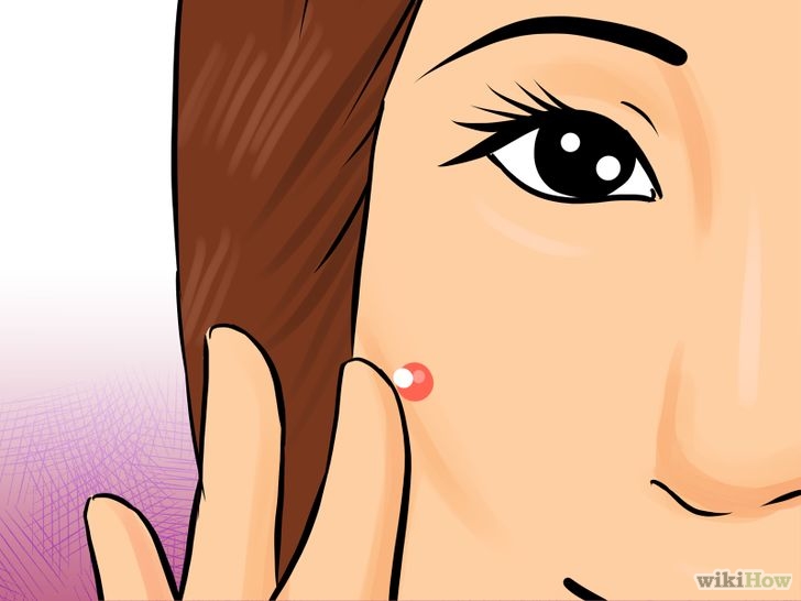 Image titled Achieve Lighter and Spot Free Skin Step 10