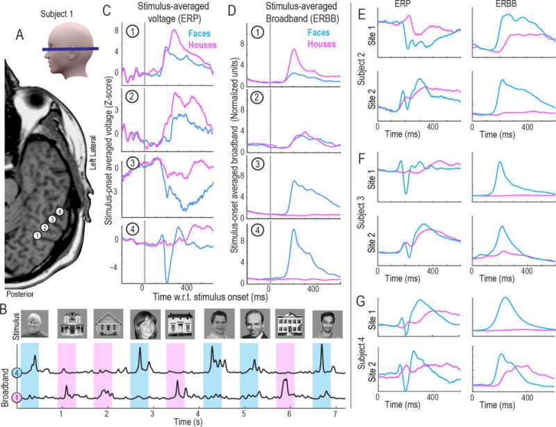 New Technique Allows Scientists to Read Minds at Nearly the Speed of Thought
