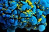 Deutsche Wissenschaftler haben es geschafft, zu besiegen, Human Immunodeficiency Virus