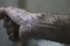 UNICEF przypomniał o braku dowodów związku microcephaly i wirusa zeke ‘ a