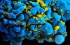 Tyska forskare kunnat besegra humant immunbristvirus
