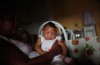 We’ve Found the Most Compelling Evidence Yet That Links Zika to Birth Defects