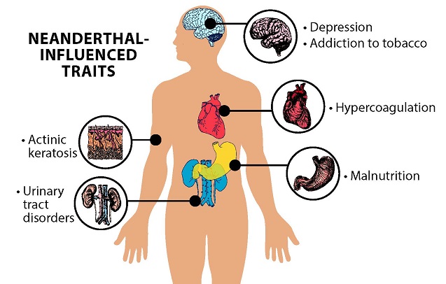 Having Neanderthal DNA Linked to Depression and Nicotine Addiction