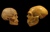 Ayant ADN de Néandertal Liée à la Dépression et la Dépendance à la Nicotine