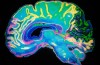 Deep sleep after a head injury can protect the brain