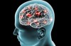 Kommer förändringen antiplate neurologi som antimateria fysik förändrats?